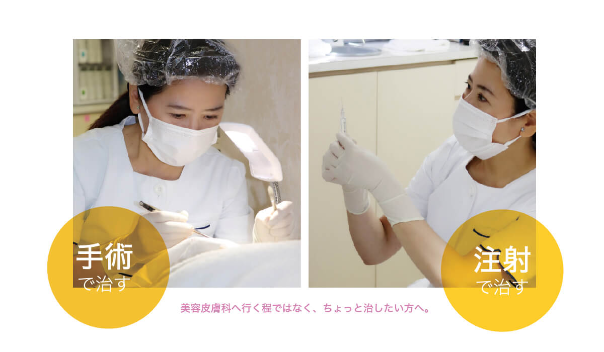 中高年の目の周りの治療