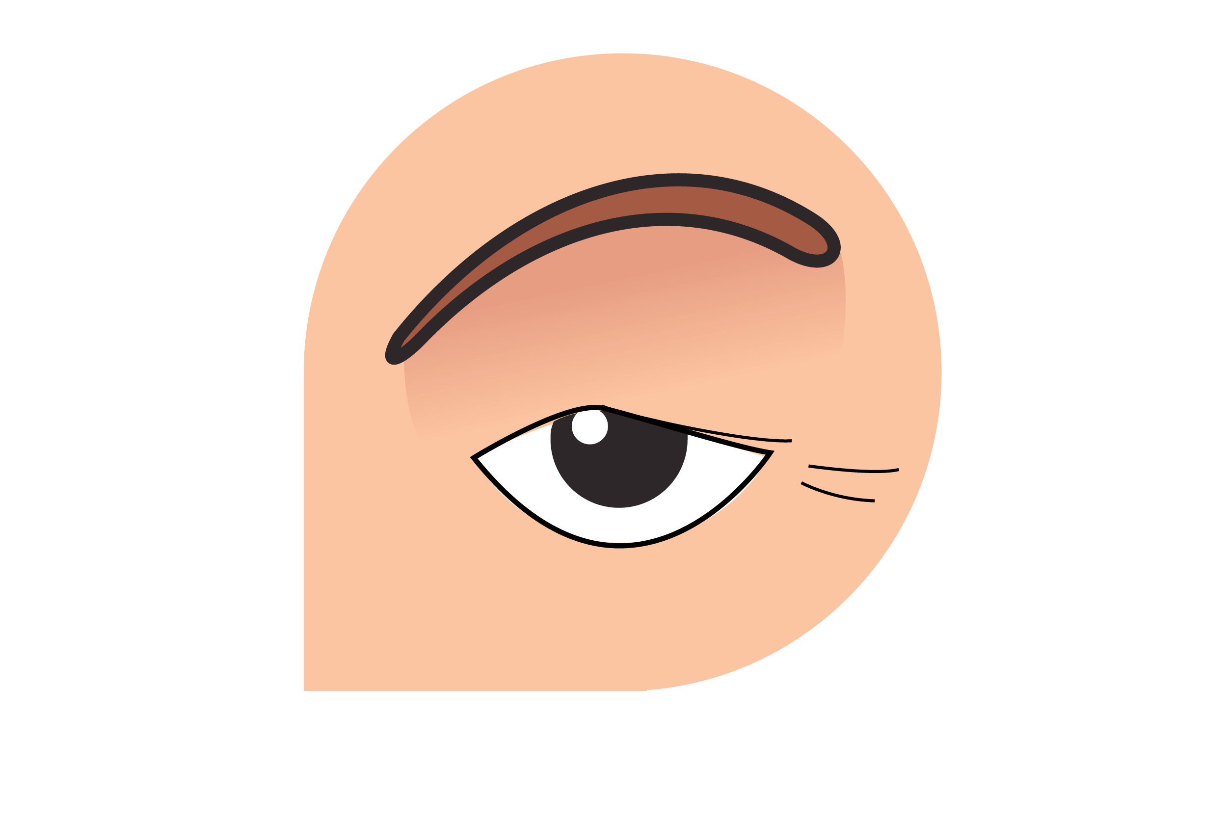 二重まぶた埋没式の図