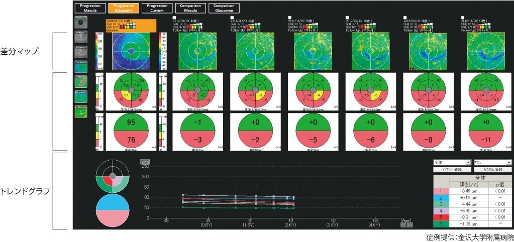フォローアップ
